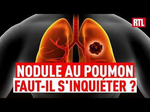 Nodule pulmonaire : quelle est cette maladie pour laquelle va être opéré le Pape Léon XIV ?